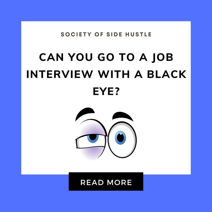 Can You Go To a Job Interview With a Black Eye?
